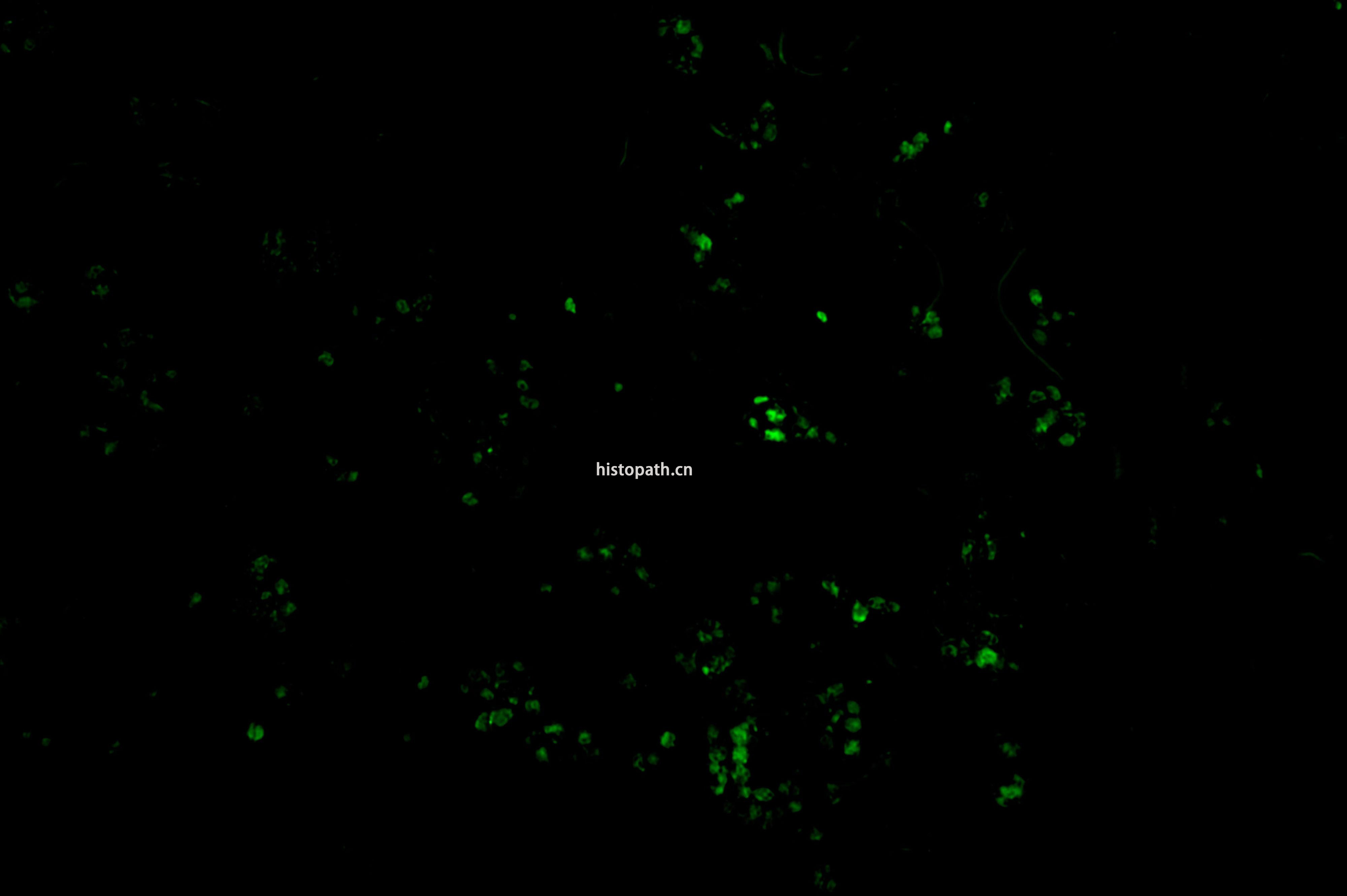 TUNEL染色荧光法